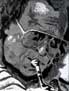 Miles Davis